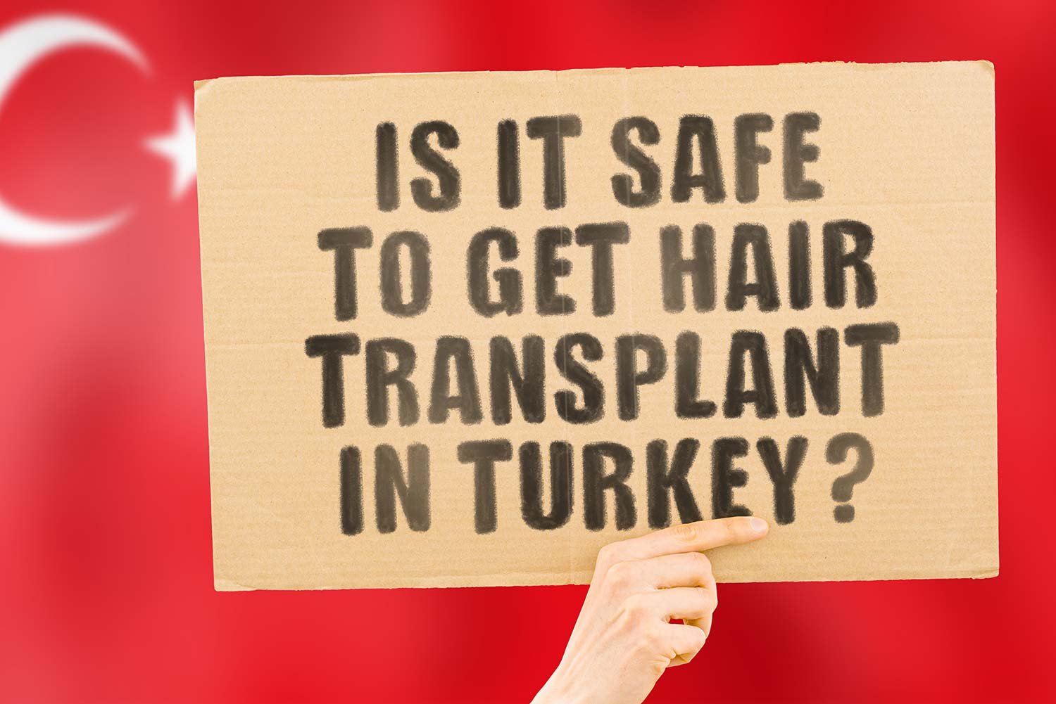 Should You Go To Turkey for a Hair Transplant