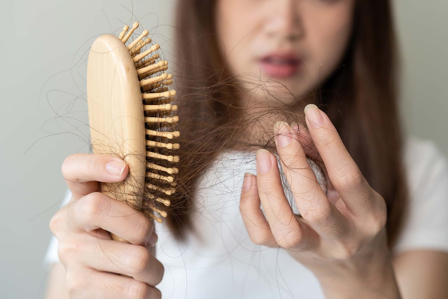 The Role of Genetics in Hair Loss and Transplant Success