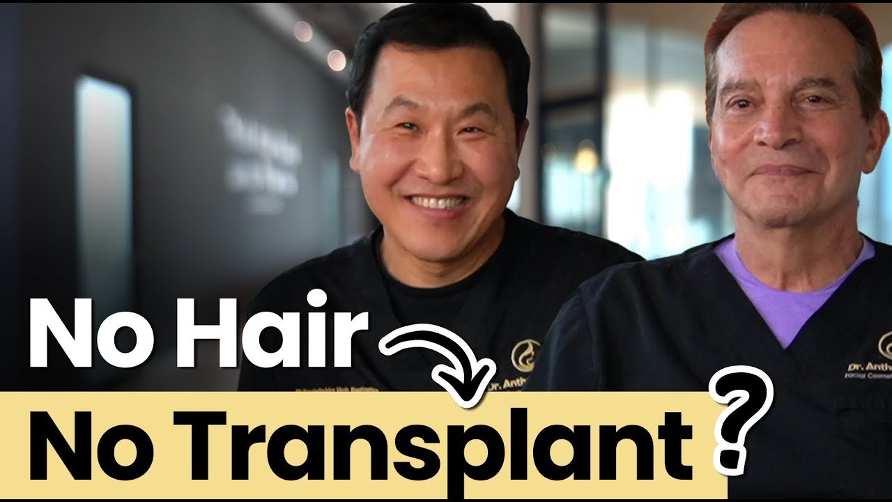 Can you get hair transplant if you're completey bald?