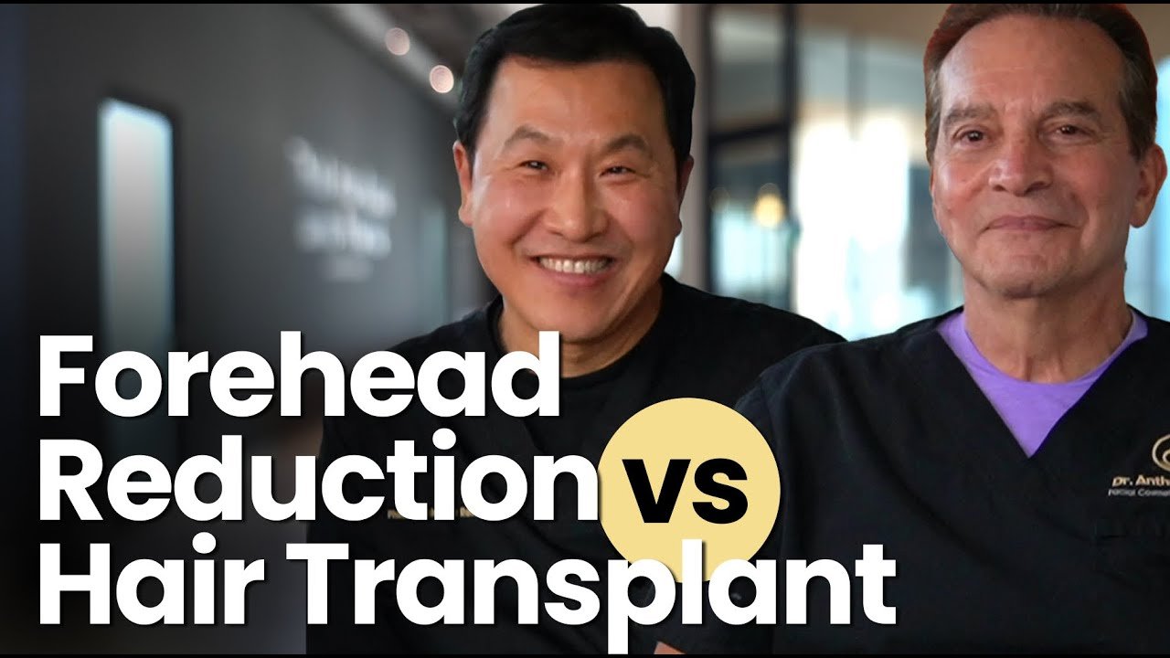 Forehead Reduction vs. Hair Transplant